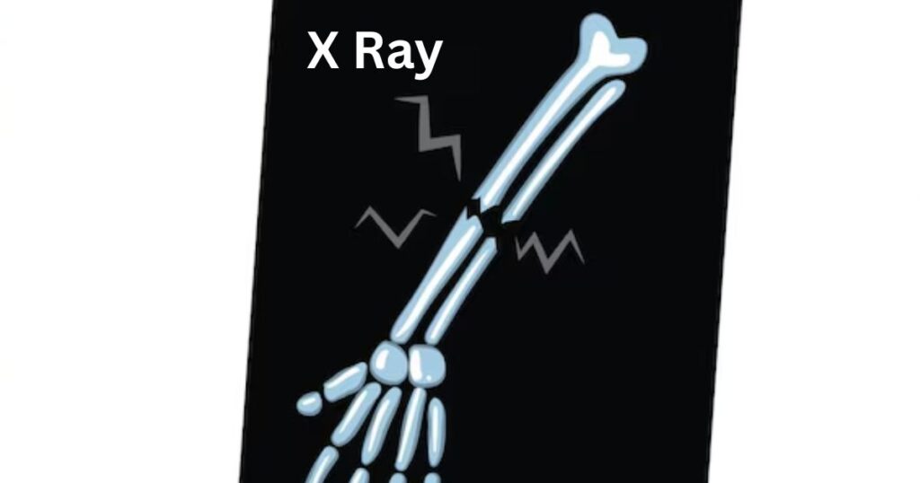 Descriptive Words Starting with X